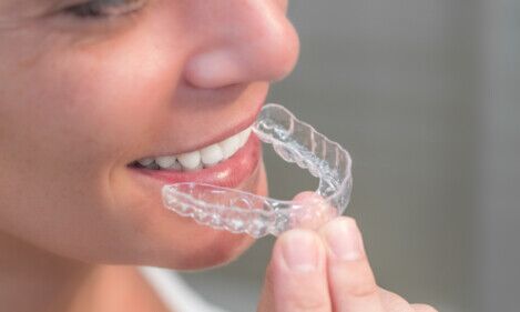Allineatore dentale a Corcolle